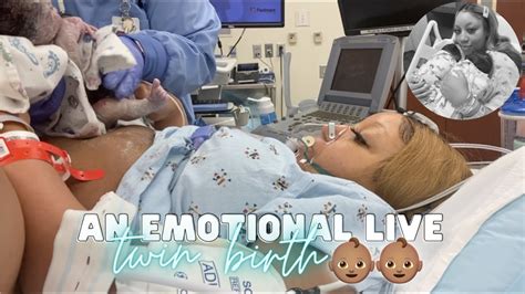 pregnant webcam live|Twin birth video: Watch live delivery of twins .